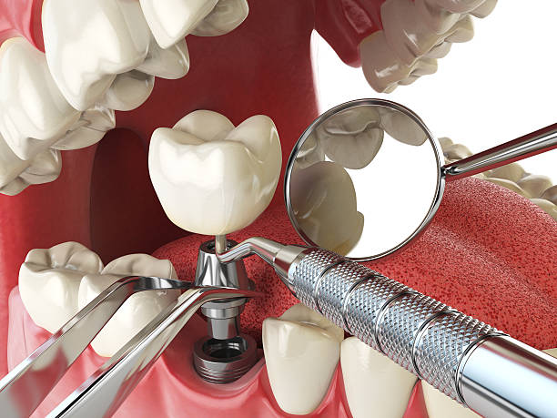 Best Emergency Treatment for Oral Infections in Anchor Point, AK